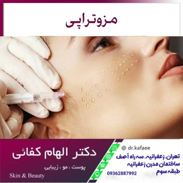 مزوتراپی