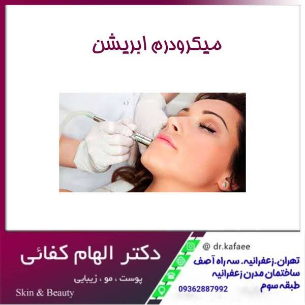 عکس میکرودرم ابریشن