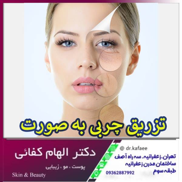 تزریق چربی به صورت - دکتر الهام کفایی