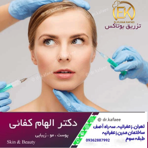 تزریق بوتاکس