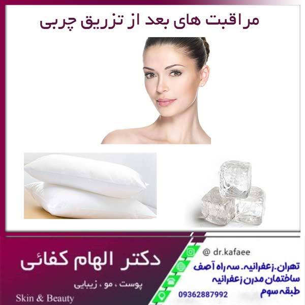 مراقبت های بعد از تزریق چربی