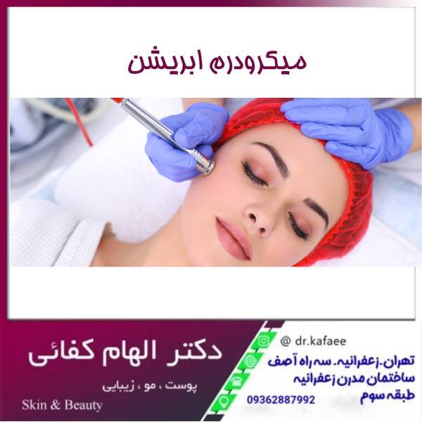 عکس میکرودرم ابریشن
